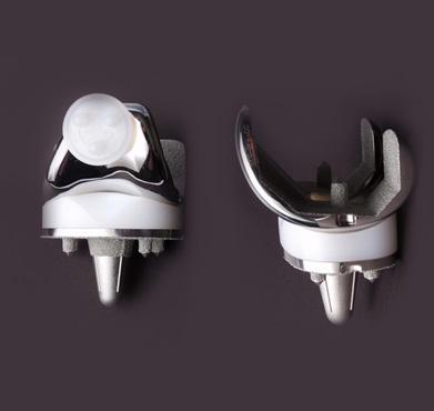 Left image - front view of a TKR, right image - side on view of a total knee replacement.